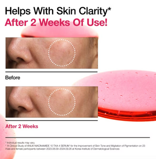 Niacinamide 10 TXA 4 Serum for Brightening and Dark Spots 4.3