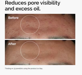 Niacinamide 10% + Zinc 1% Serum for Oily Skin